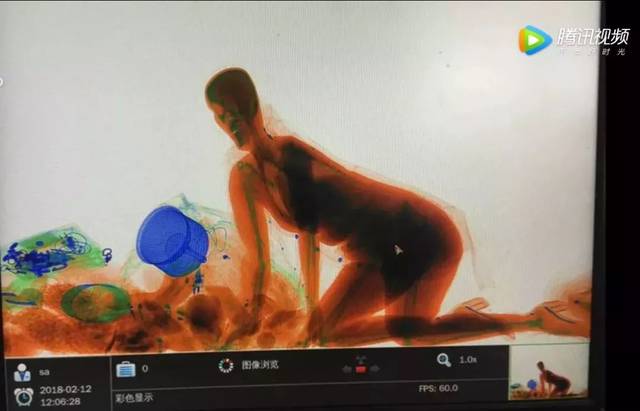 X光機